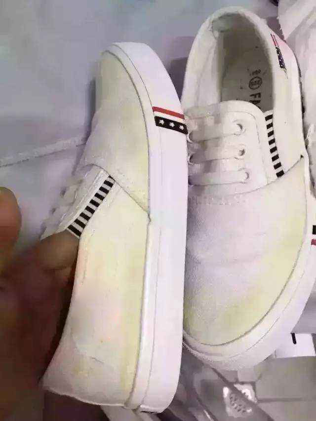 Why Are The White Shoes Easily Yellowed, How To Get Yellow Stains Out Of White Leather Shoes
